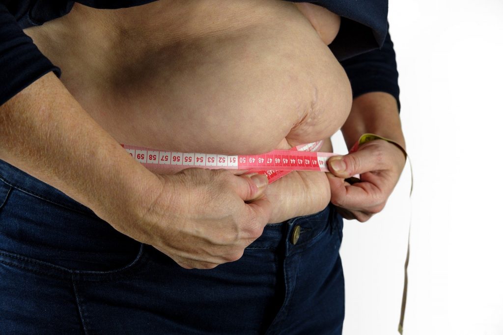 3D lipo trumps liposuction - here's why -