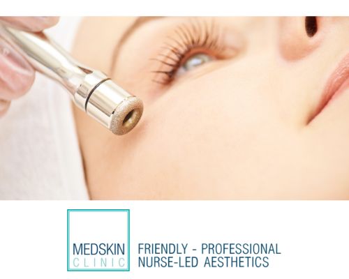 Microdermabrasion-local-private-clinic-private-nhs-nurses-are-based-in-Nottingham-Beeston-West-Bridgford-Chesterfield-Newark-Leicester-Derby-and-Lincoln.-2.jpg