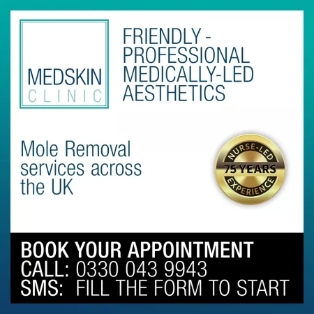 Mole Removal Nuneaton -